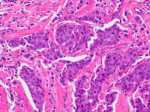 奥林巴斯显微镜