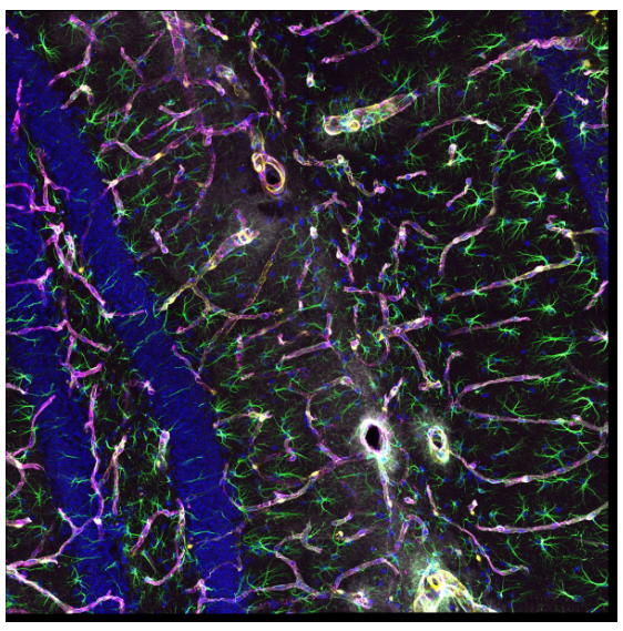 奥林巴斯显微镜